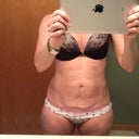 Front approx one month pre op