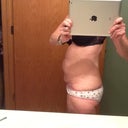 Side, one month pre op