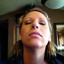 Still super swollen in between the nostrils and swollen lips