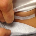 incision site