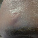 Notice the rough texture of my forehead.