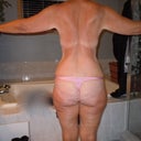 11/28 before picture