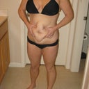 disgusting pre op picture