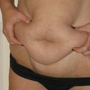 disgusting pre op
