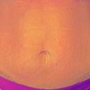 Stomach 48 hours After (no more tattoo)