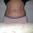 before abs