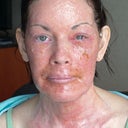Day 3 Post