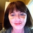 This photo was taken at 28 days.  You can still see some bruising.