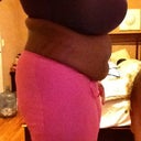 before pic side