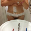 post op day 2 - slightly hunched over but not too bad
