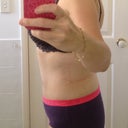 post op day 10 can stand up straight but still walking slightly hunched
