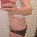 post op 4 weeks