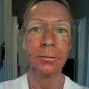Day 3 - AM Still quite red