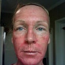 Day 3 - PM Seems even more redder
