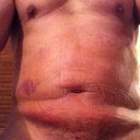 1st day after lipo, completely relaxed