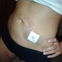 touch up around belly button