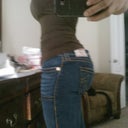 Two weeks post surgery