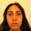 After-4 weeks (I dislike how my nose looks very uneven and swollen and unfortunately this is how my nose looks half the time from 2-4 weeks during recovery ;( hopefully it'll resolve)