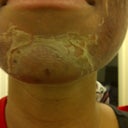 Face peeling