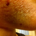 Day 2/Face Started looking leathery