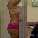 15 days post op wanted a much bigger projection
