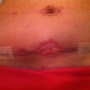 The next day after a shower. Still very swollen, the opening is pretty gross.
