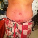 Getting better. Less swollen and the opening is getting smaller.