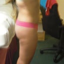 Right side view