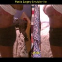 Me before...Me hopefully after!!!