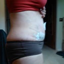 9days PO side view