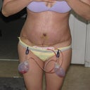 day 6 still swollen