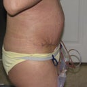 day 6 still swollen