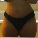 17 days post op