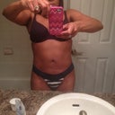1 year post op abs