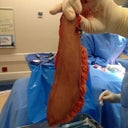 My friend/co-worker sat in for my surgery and took some pics for me.  This is my lower abdomen!!  Buh-bye!