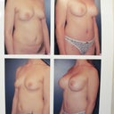 before and after