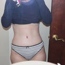 26 days post op
