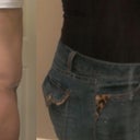 Day 20. Above my BB looks pretty much normal, I think. Below my BB is still rounded and swollen, but the swelling is continuing to go down, especially after the crunches fiasco of Day 17. I thought this picture showed the swelling really well, and I will keep taking pictures to track progress. It is only in the last few days that my upper abdomen has been looking about normal. I was entirely swollen for greater than two and a half weeks. The picture on the right is pretty exciting! Those are my pre-surgery jeans, size 6. It appears that I have a few extra inches in those now!!! <3