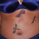 After TT (front) @ 6 wks