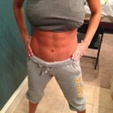 7 months post op