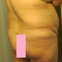 Ok, I guess I didn't realize how bad I looked in back until this picture.