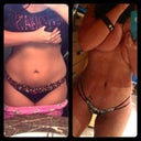 Before and after front at 1 month post op