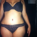 in order to cover the scar I have to lower the sides of my underwear