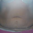 Pre-op disgust!