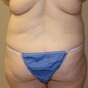 Pre-op back rolls - yuck!
