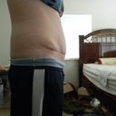 21 days post op (3 weeks)