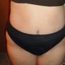 9 weeks Post op.