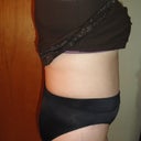 9 weeks Post Op