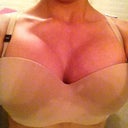 VS 34DD 2.5 weeks