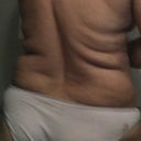 Back view post 2 days